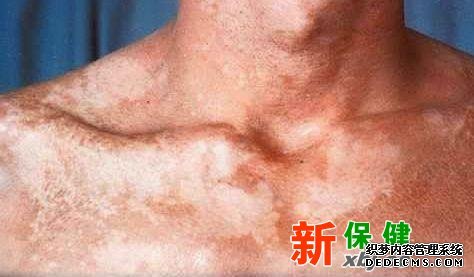 http://www.xywy***/bj/