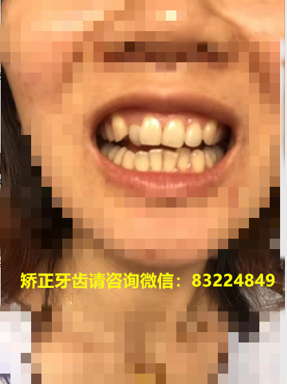 1_副本.png
