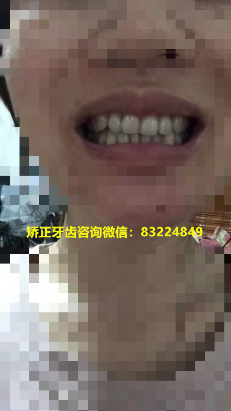 3_副本.png